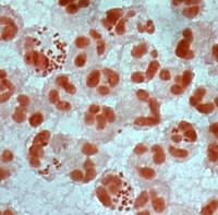 Gram stain of urethral gonorrheal exudate, showing neutrophils with associated gonococci. From Johnson and Criss, Frontiers in Microbiology 2011.