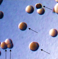 Opacity phenotypes of colonies of N. gonorrhoeae. Arrows point to colonies of bacteria expressing Opa proteins. From Ball and Criss, Journal of Bacteriology 2013.