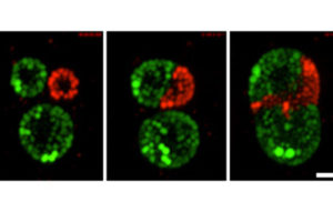 Three side-by-side images of pathogenesis