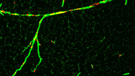 Green dye to show the Mechanisms of tumor neovascularization