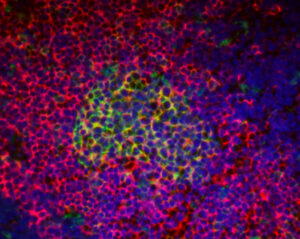 Germinal center B cells undergoing the formation of extracellular vesicles. Courtesy of the Erickson Lab.