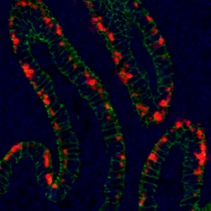 Caption: Chlamydia (red) replicating in epithelial cells (green) of the murine female genital tract. Photo courtesy of Isabelle Derré
