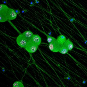 Herpes simplex virus (HSV) latency in neurons